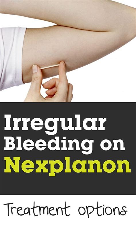 Nexplanon pregnancy stories. Things To Know About Nexplanon pregnancy stories. 